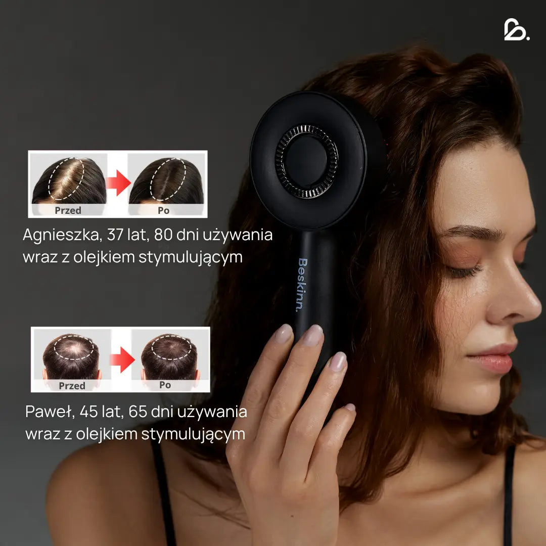 Masażer skóry głowy VitalScalp™