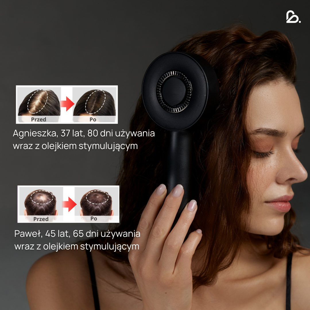 Masażer skóry głowy VitalScalp™